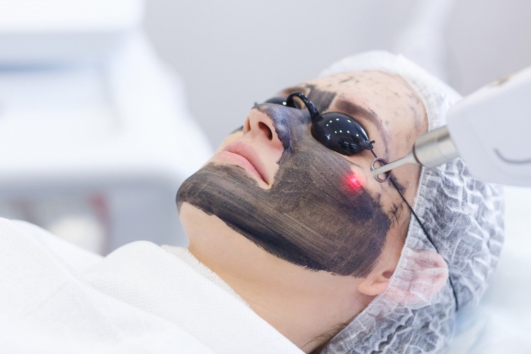 công nghệ tái tạo da bằng laser